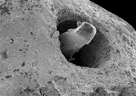 patencia apical.